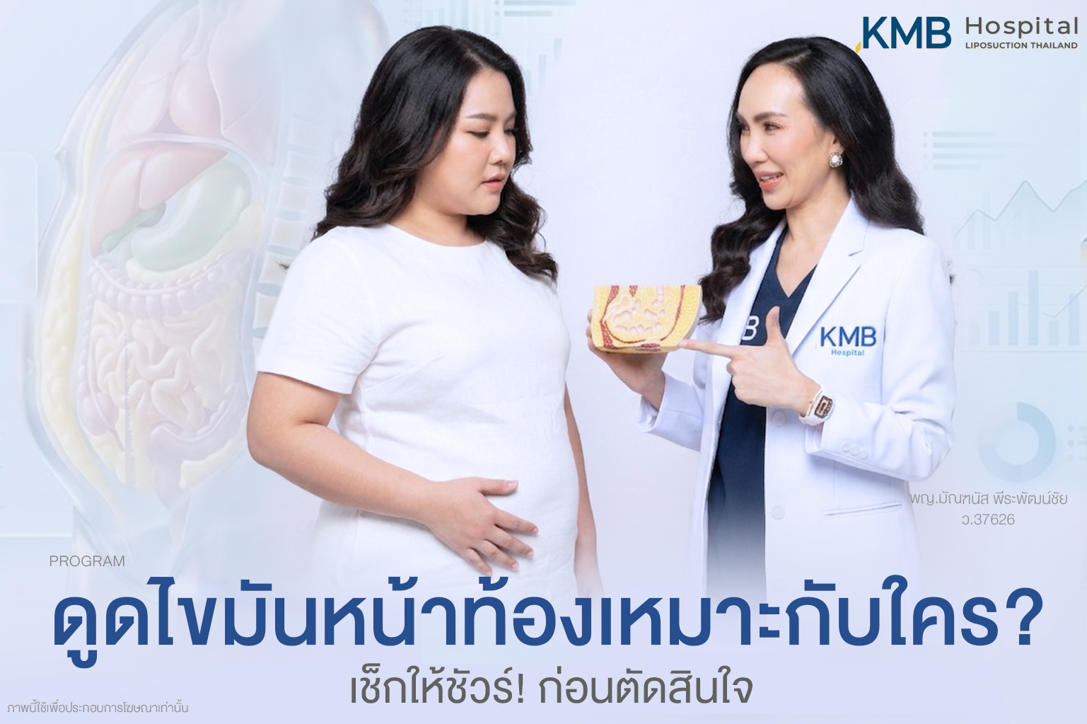 ผู้หญิงกำลังปรึกษาแพทย์เกี่ยวกับโปรแกรมดูดไขมันหน้าท้อง เหมาะกับใครและต้องประเมินอย่างไร
