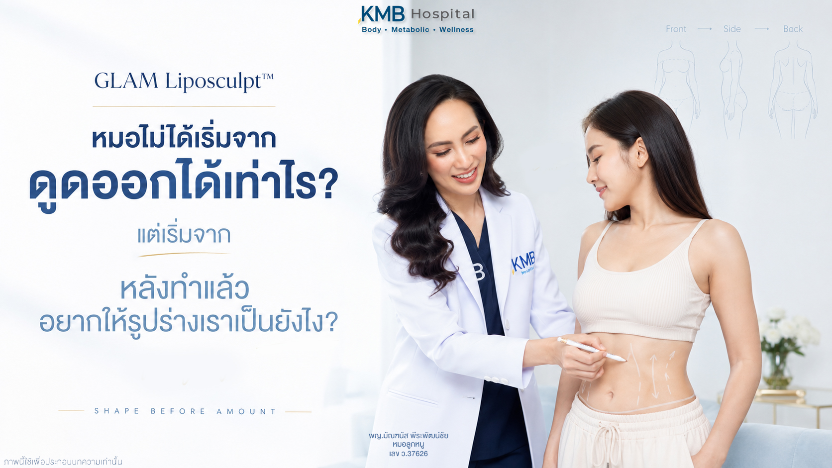 หมอลูกหนูวางแผนดูดไขมันแบบ GLAM Liposculpt™ โดยเริ่มจากการออกแบบรูปร่างก่อนพิจารณาปริมาณไขมัน