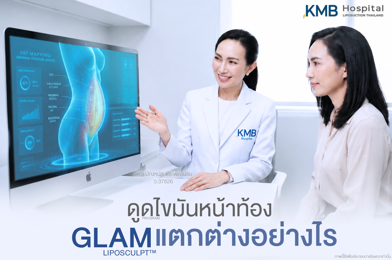 "เปรียบเทียบการดูดไขมันหน้าท้องแบบ GLAM Liposculpt™ เน้นสัดส่วนและผิวเรียบตึง"