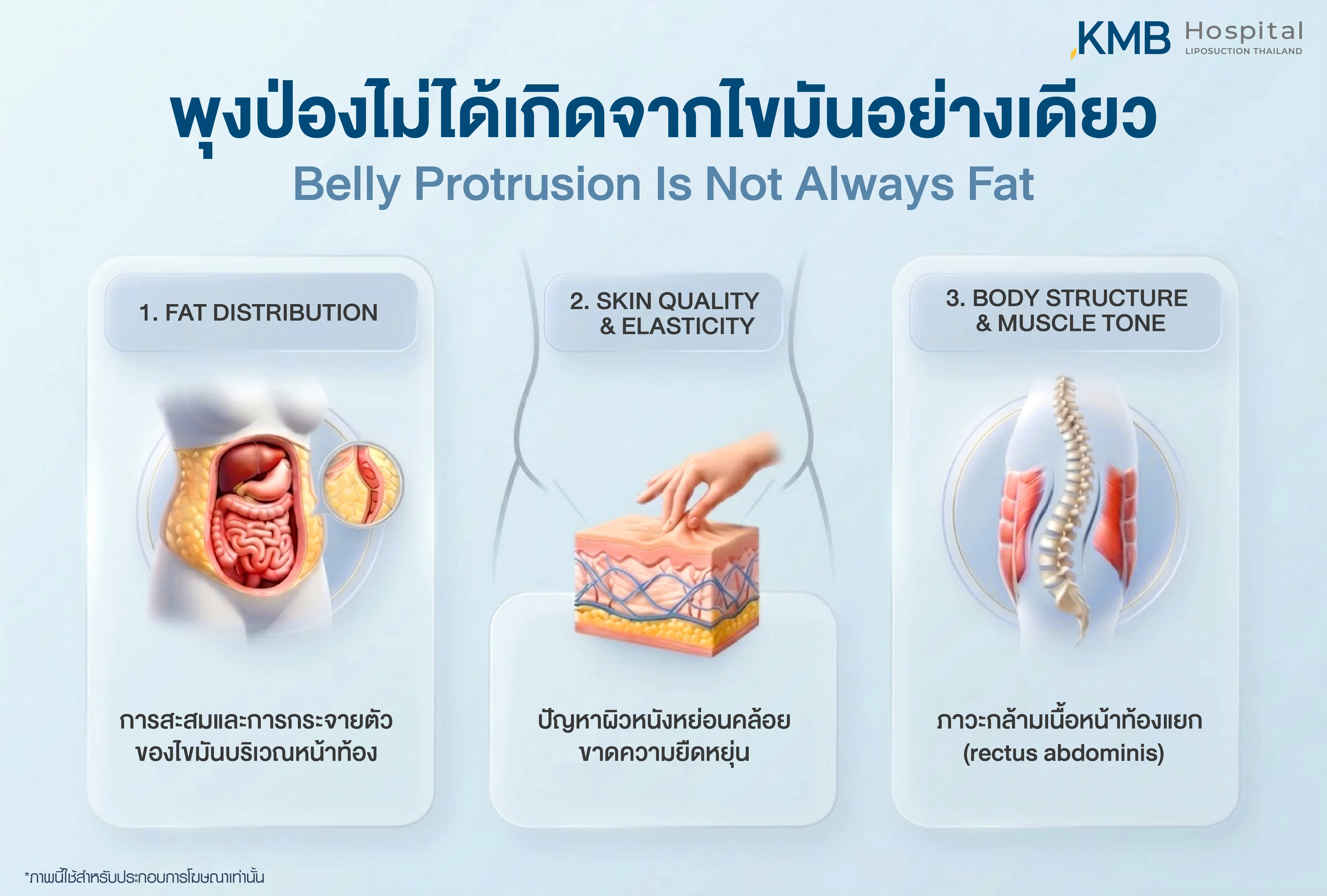 Medical infographic explaining causes of belly protrusion before abdominal liposuction assessment