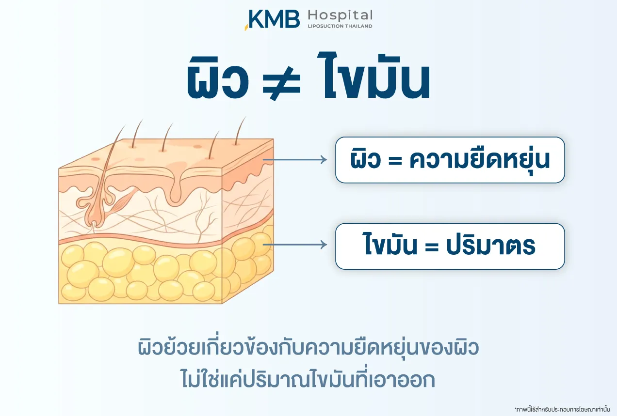 อินโฟกราฟฟิกแสดงโครงสร้างผิวและชั้นไขมันเพื่ออธิบายว่าผิวกับไขมันเป็นคนละเรื่อง