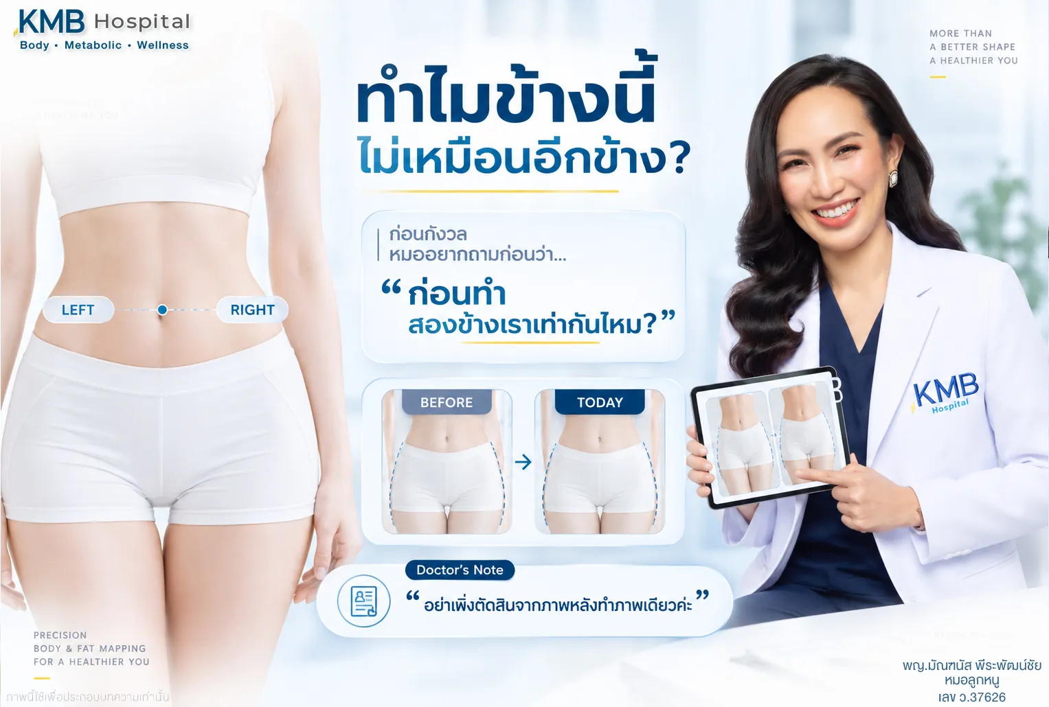 หมอลูกหนูเปรียบเทียบรูปร่างซ้ายและขวากับข้อมูลก่อนทำ เพื่อประเมินความไม่เท่ากันหลังดูดไขมัน