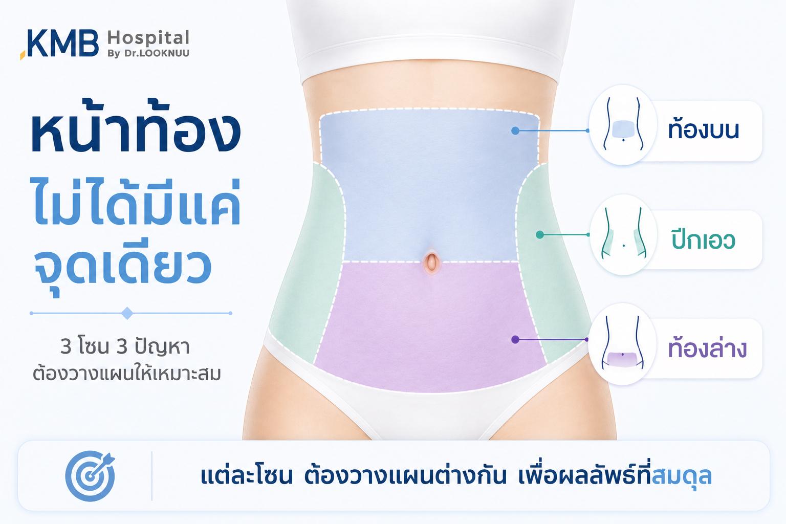การแบ่งโซนหน้าท้อง ท้องบน ท้องล่าง และปีกเอว สำหรับวางแผนโปรแกรมดูดไขมันหน้าท้องที่ KMB Hospital