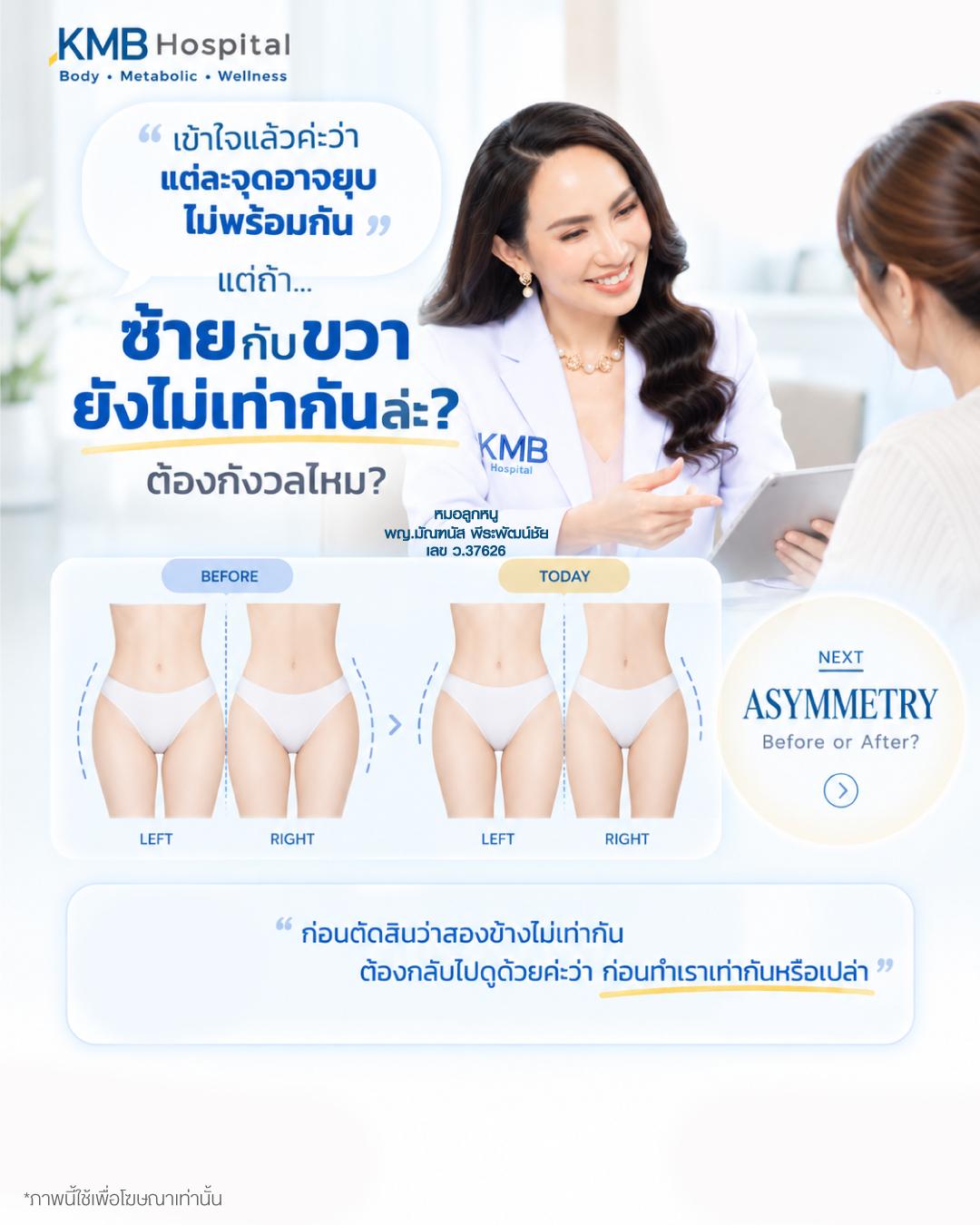 ภาพเกริ่นคำถามเรื่องความไม่เท่ากันของสองข้างหลังดูดไขมัน และการเปรียบเทียบกับรูปร่างก่อนทำ