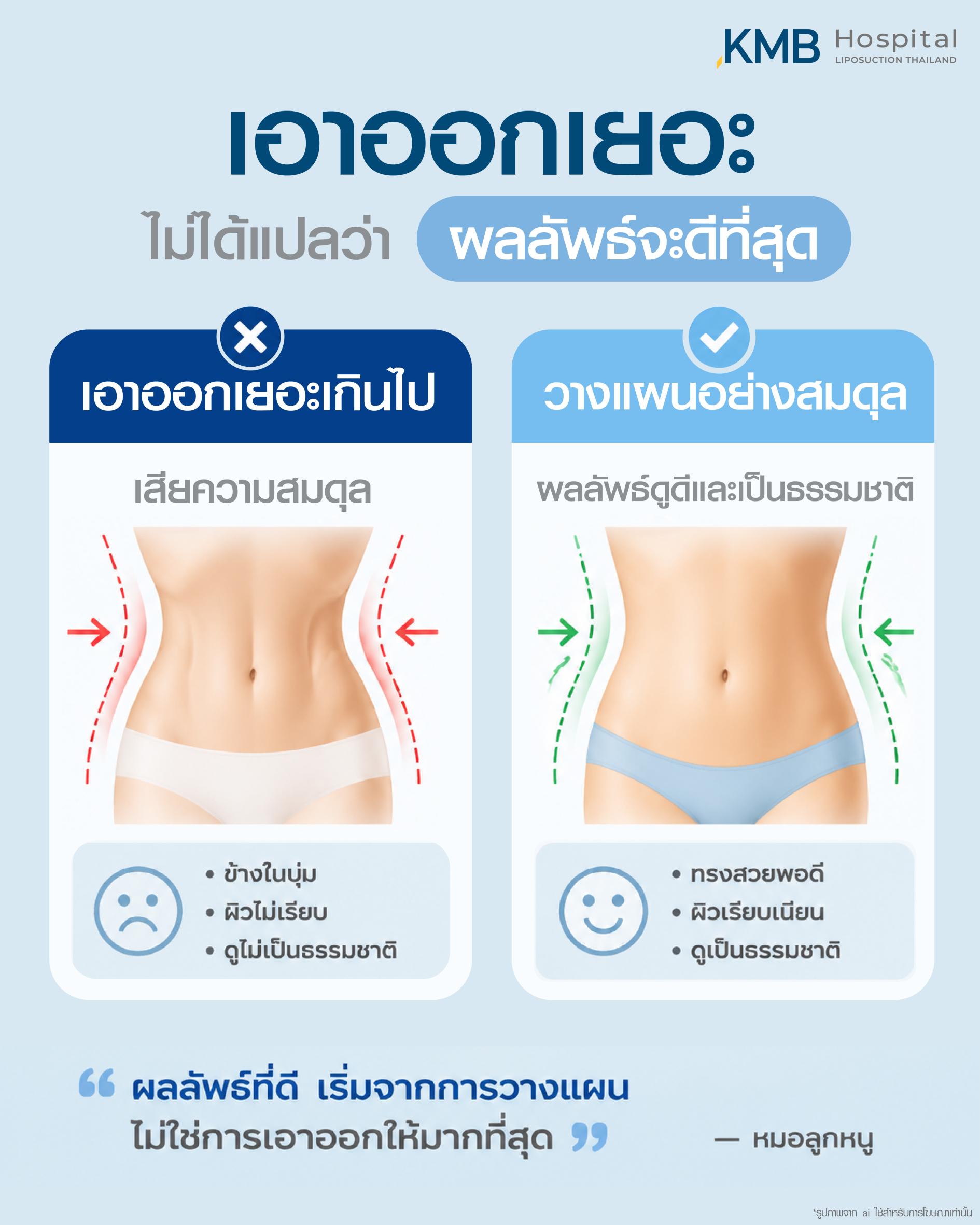 วางแผนตำแหน่งไขมันหน้าท้องอย่างสมดุล เพื่อผลลัพธ์เรียบ กระชับ และสัดส่วนเป็นธรรมชาติ โดย KMB Hospital