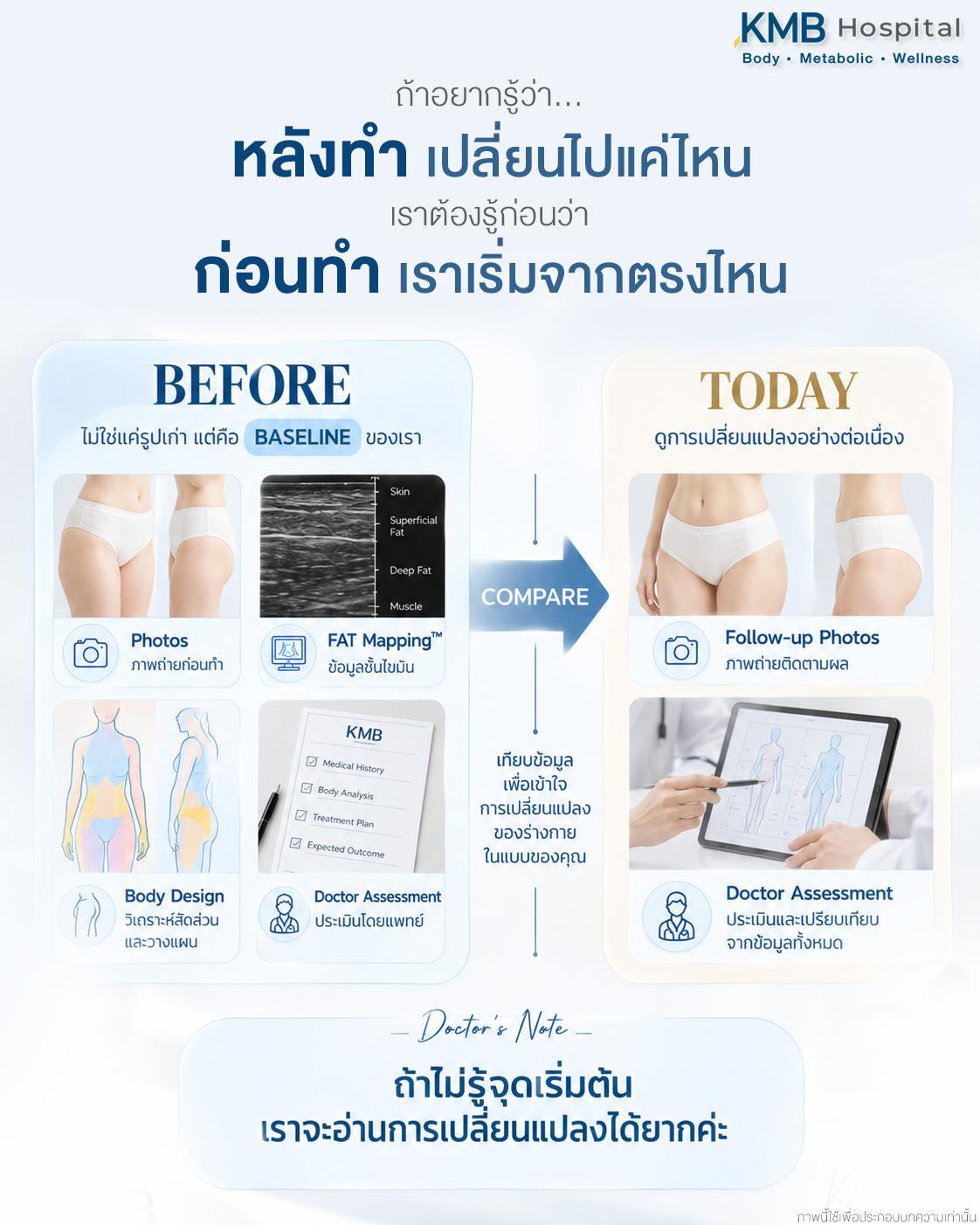 ภาพแสดงการใช้ข้อมูลก่อนทำเป็น Baseline เพื่อเปรียบเทียบกับการเปลี่ยนแปลงของรูปร่างหลังดูดไขมัน