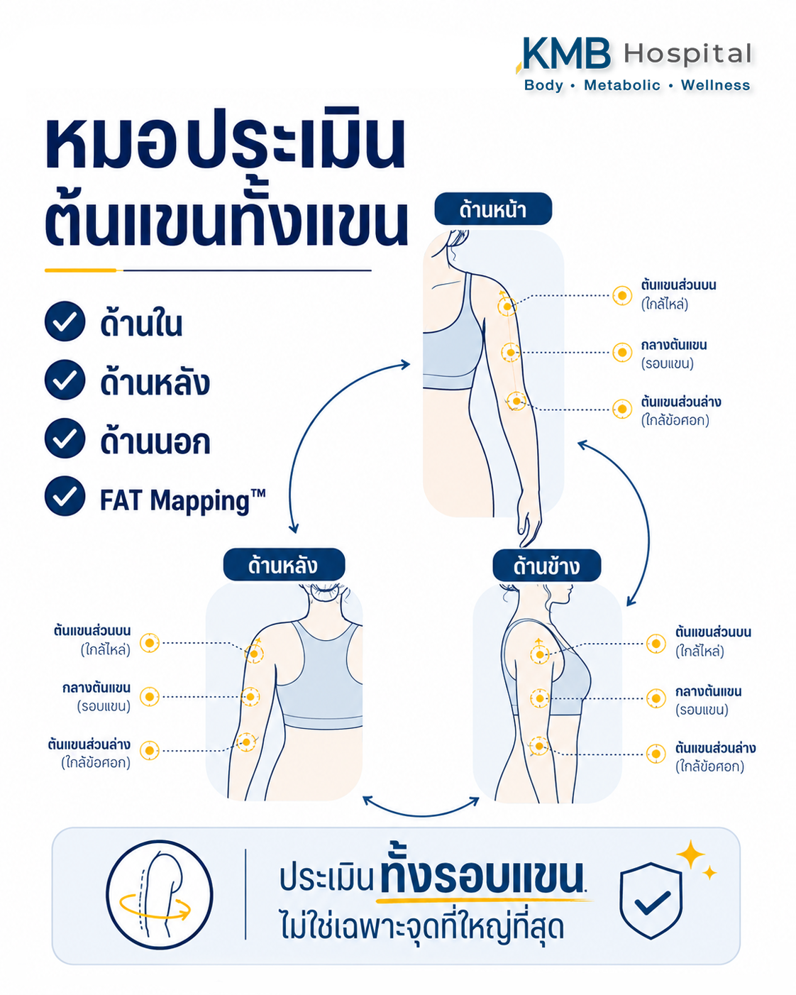 อินโฟกราฟิกแสดงการประเมินต้นแขนด้วย FAT Mapping™ ก่อนดูดไขมัน