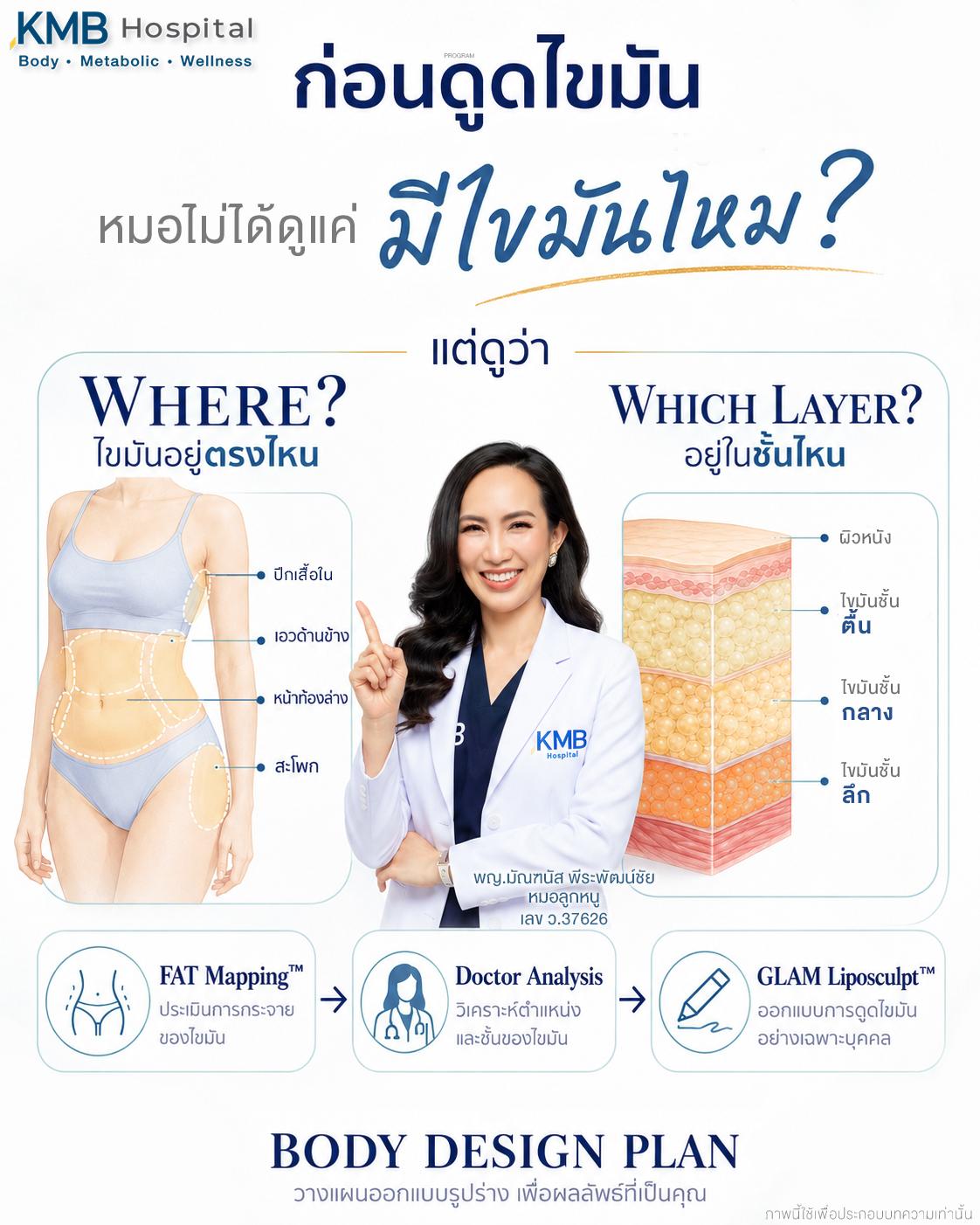 ภาพอธิบายตำแหน่งและชั้นไขมันที่หมอลูกหนูนำมาพิจารณาก่อนออกแบบการดูดไขมันแบบ GLAM Liposculpt™