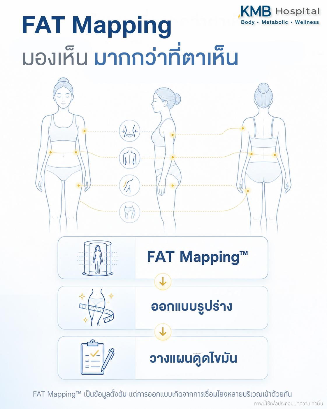 FAT Mapping™ ช่วยให้หมอลูกหนูมองเห็นความสัมพันธ์ของแต่ละบริเวณ ก่อนนำข้อมูลทั้งหมดมาออกแบบรูปร่างและวางแผนดูดไขมัน