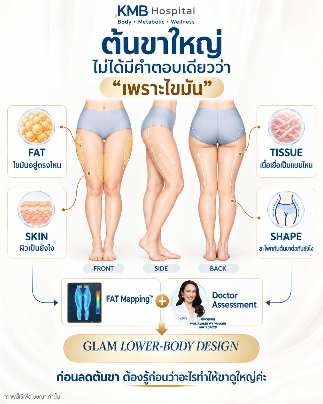 ภาพอธิบายปัจจัยเรื่องไขมัน ผิว เนื้อเยื่อ และ Shape ที่แพทย์ประเมินก่อนดูดไขมันต้นขา