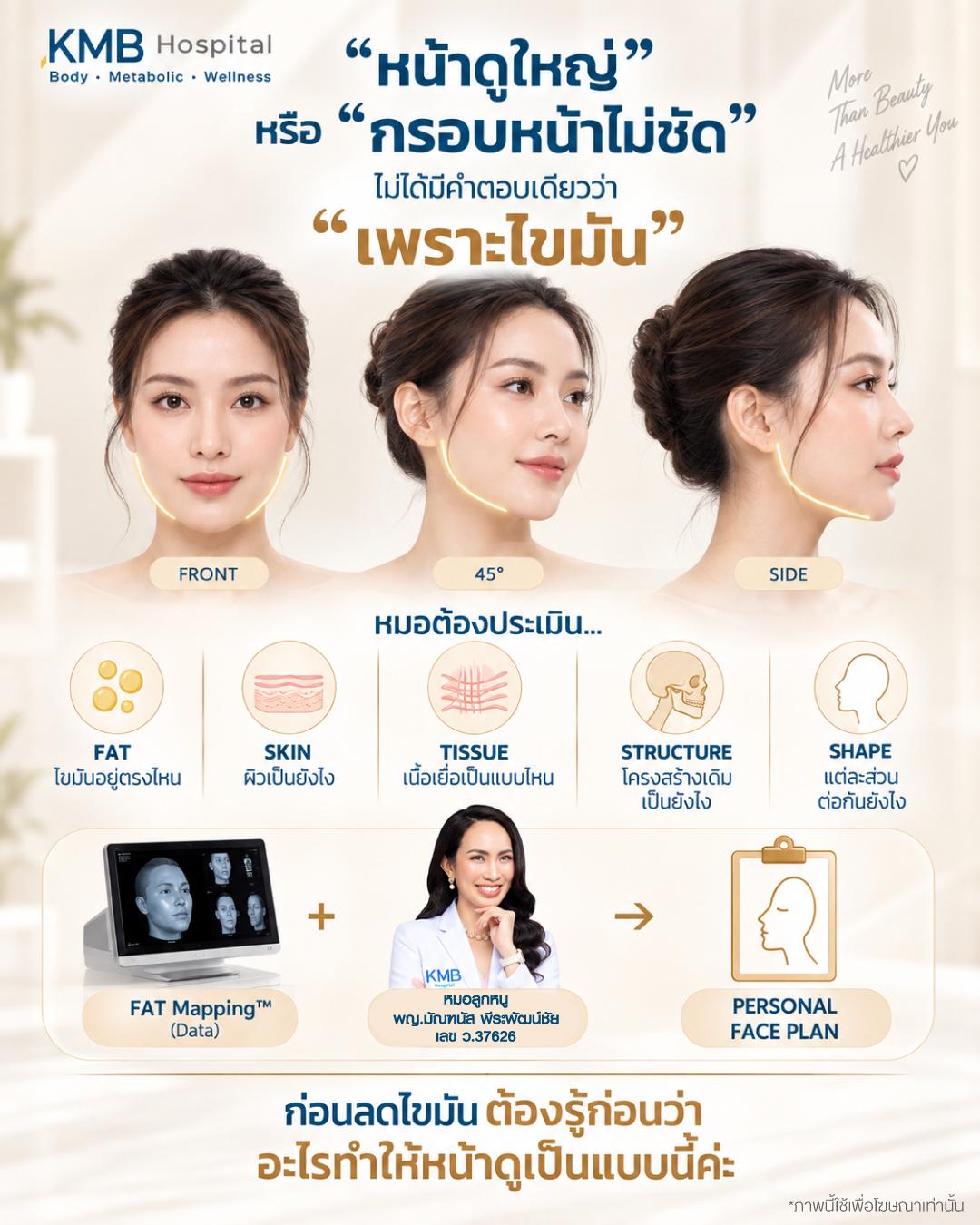 ภาพอธิบายปัจจัยเรื่องไขมัน ผิว เนื้อเยื่อ โครงสร้าง และรูปหน้าที่แพทย์ประเมินก่อนวางแผนดูดไขมันเหนียงและกรอบหน้า