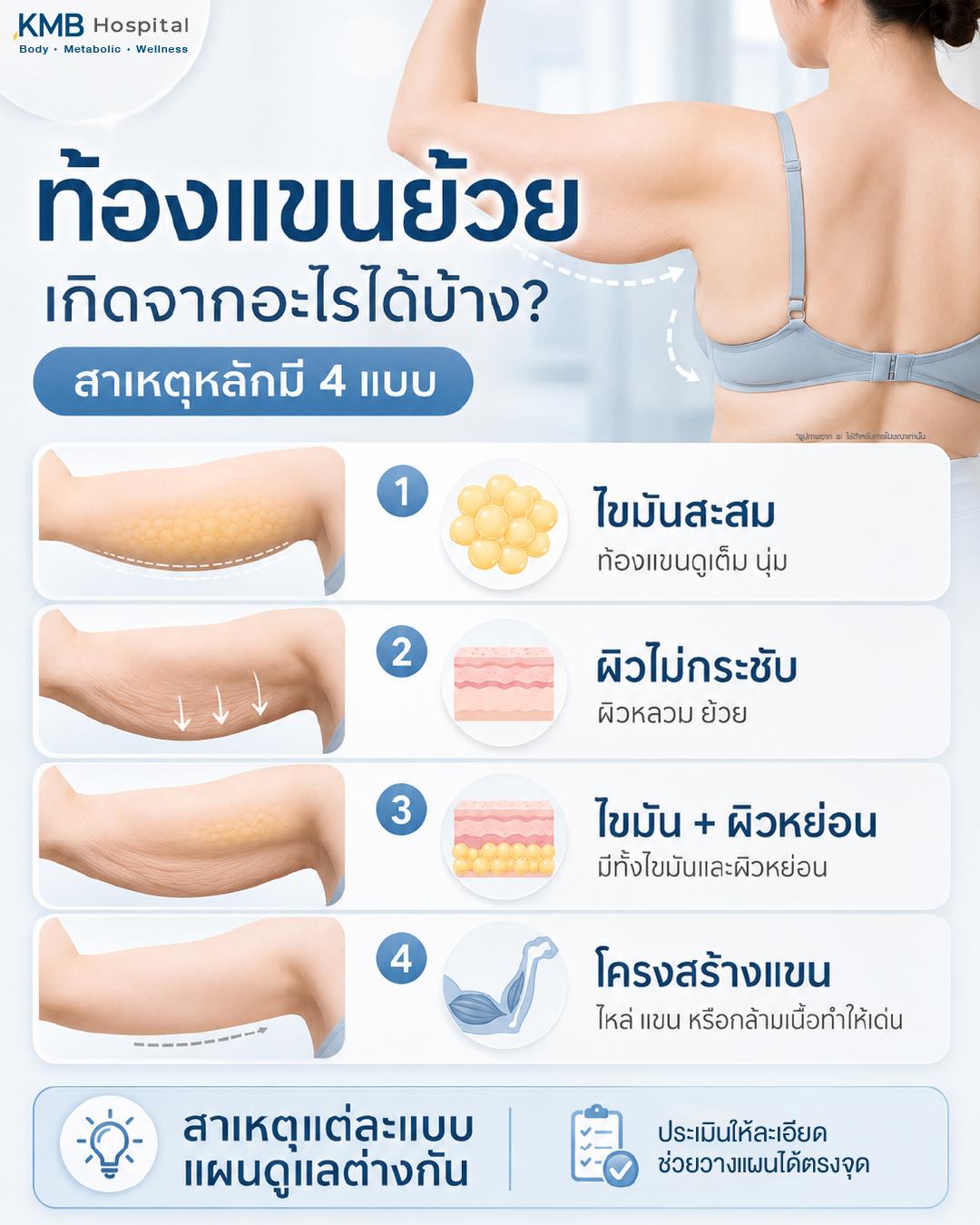 ท้องแขนย้วยเกิดจากอะไรได้บ้าง โดยสาเหตุหลักอาจมาจากไขมันสะสม ผิวไม่กระชับ ไขมันร่วมกับผิวหย่อน หรือโครงสร้างแขน กล้ามเนื้อ และไหล่ที่ทำให้ต้นแขนดูเด่น จึงควรประเมินให้ละเอียดก่อนวางแผนดูแลต้นแขนหรือโปรแกรมดูดไขมันแขนให้ตรงจุด