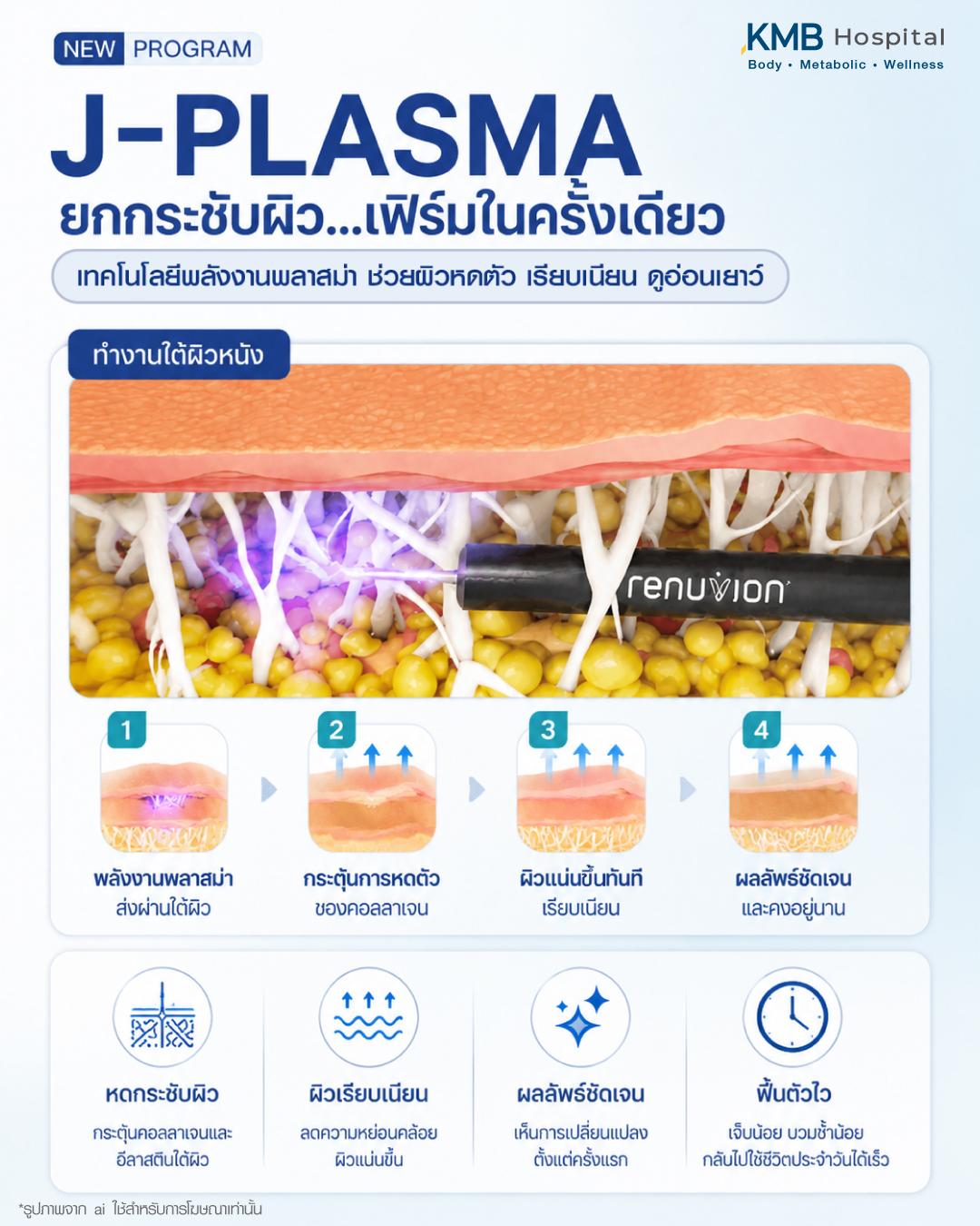 ภาพอธิบายการทำงานของ J-Plasma ที่ส่งพลังงานพลาสม่าลงสู่ชั้นไขมันใต้ผิว กระตุ้นการหดตัวของคอลลาเจน ช่วยยกกระชับผิว ลดความหย่อนคล้อย และปรับโครงสร้างผิวให้เรียบเนียน