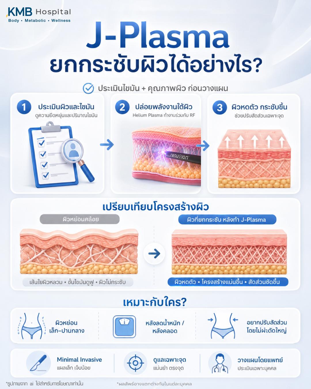 อินโฟกราฟิกอธิบายการทำงานของ J-Plasma ตั้งแต่การประเมินผิว การปล่อยพลังงานฮีเลียมพลาสมาเพื่อกระชับชั้นผิว และการเปรียบเทียบผิวก่อน–หลัง เพื่อช่วยลดความหย่อนคล้อยและปรับสัดส่วนเฉพาะจุดที่ KMB Hospital
