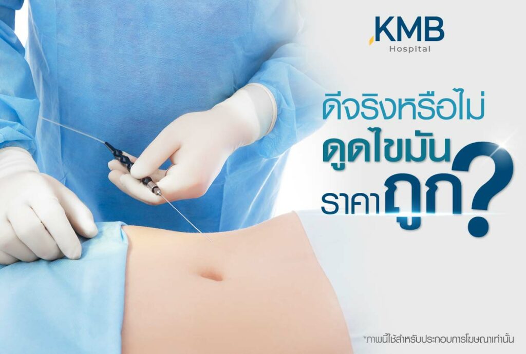 ราคาดูดไขมัน-หมอลูกหนู