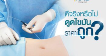 ราคาดูดไขมัน-หมอลูกหนู