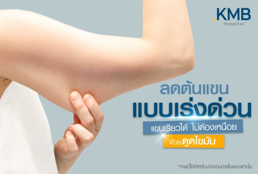 ดูดไขมันแขน-หมอลูกหนู