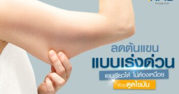 ดูดไขมันแขน-หมอลูกหนู