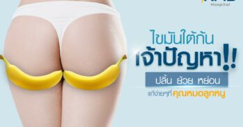 ไขมันใต้ก้น-หมอลูกหนู-KMB-ดูดไขมันก้น