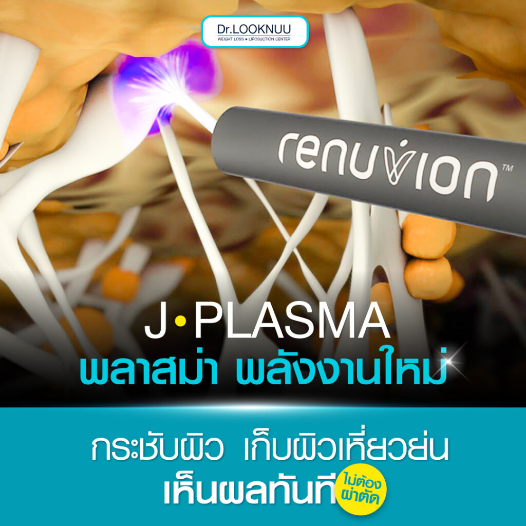j plasma