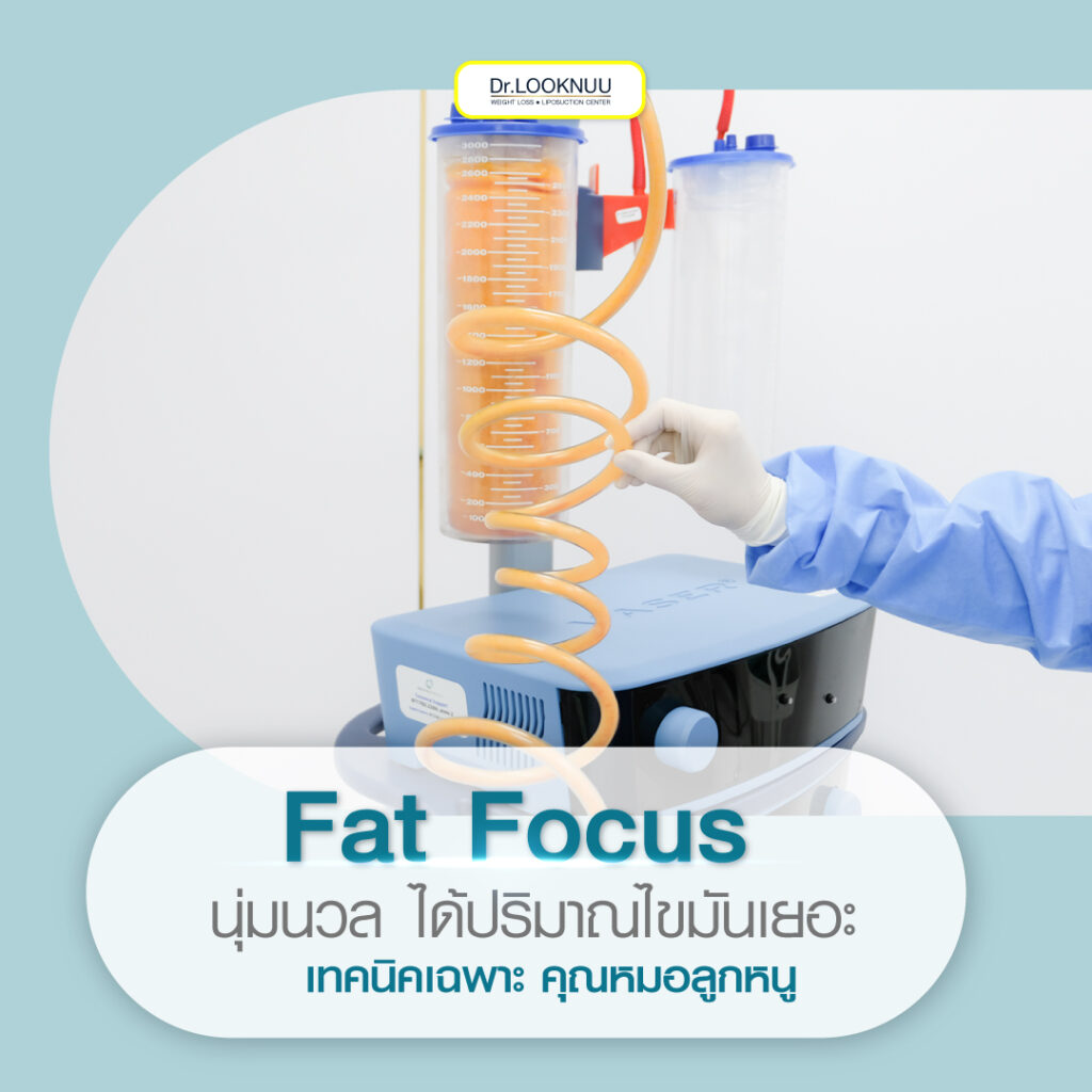 Fat Focus
