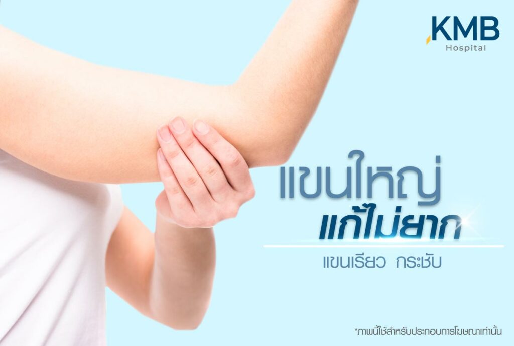 ดูดไขมันแขน-หมอลูกหนู-kmb