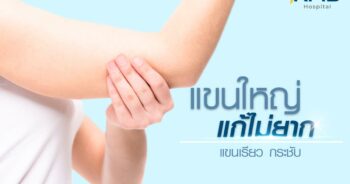ดูดไขมันแขน-หมอลูกหนู-kmb