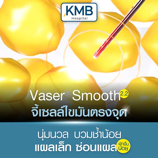 vaser smooth 2.2