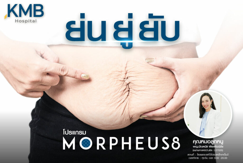 มอเฟียส-หมอลูกหนู