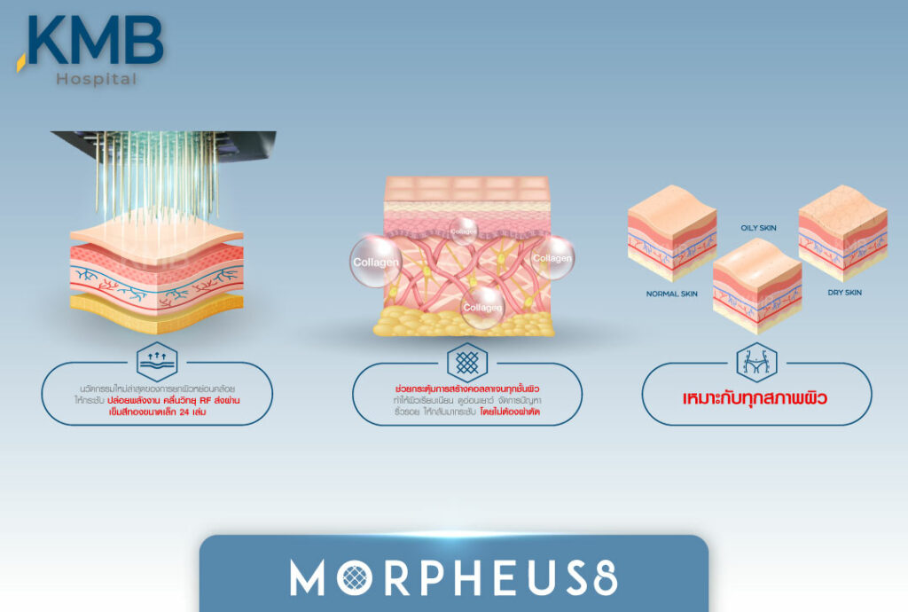 morpheus-หมอลูกหนู