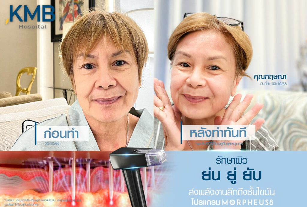 มอเฟียส-หมอลูกหนู