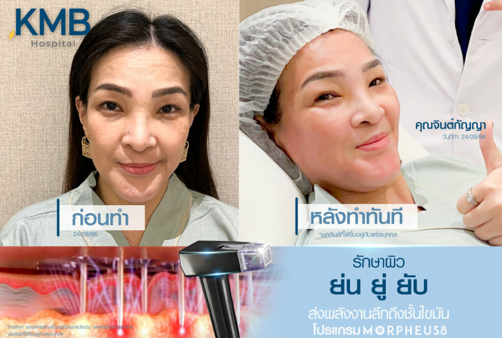 มอเฟียส-หมอลูกหนู