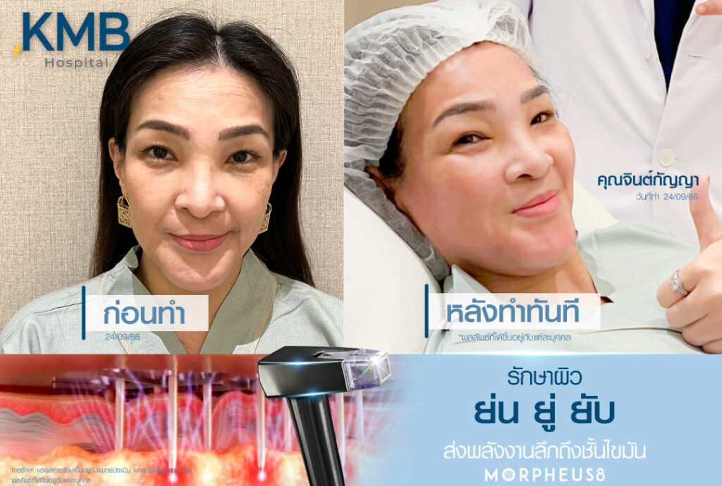 morpheus-หมอลูกหนู