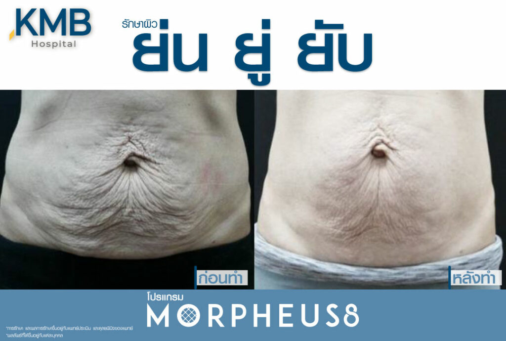 มอเฟียส-หมอลูกหนู