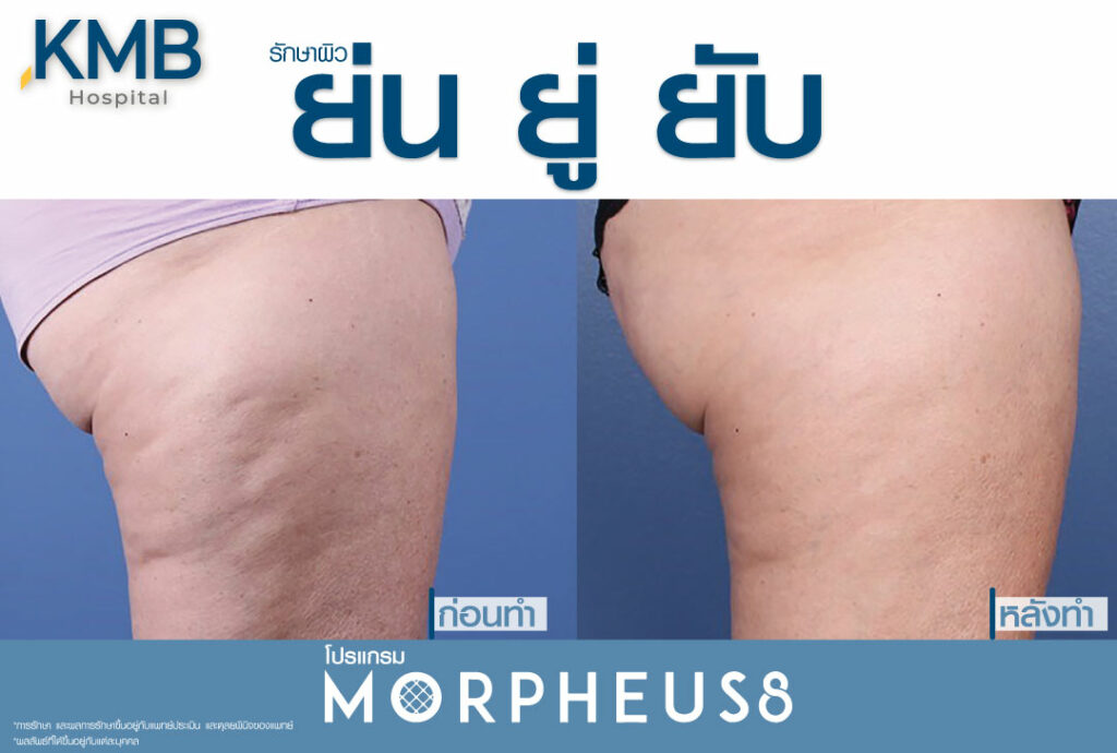 มอเฟียส-หมอลูกหนู