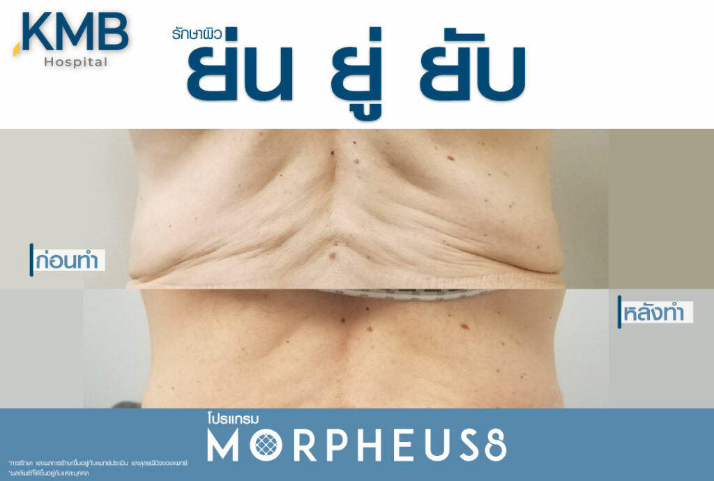 มอเฟียส-หมอลูกหนู