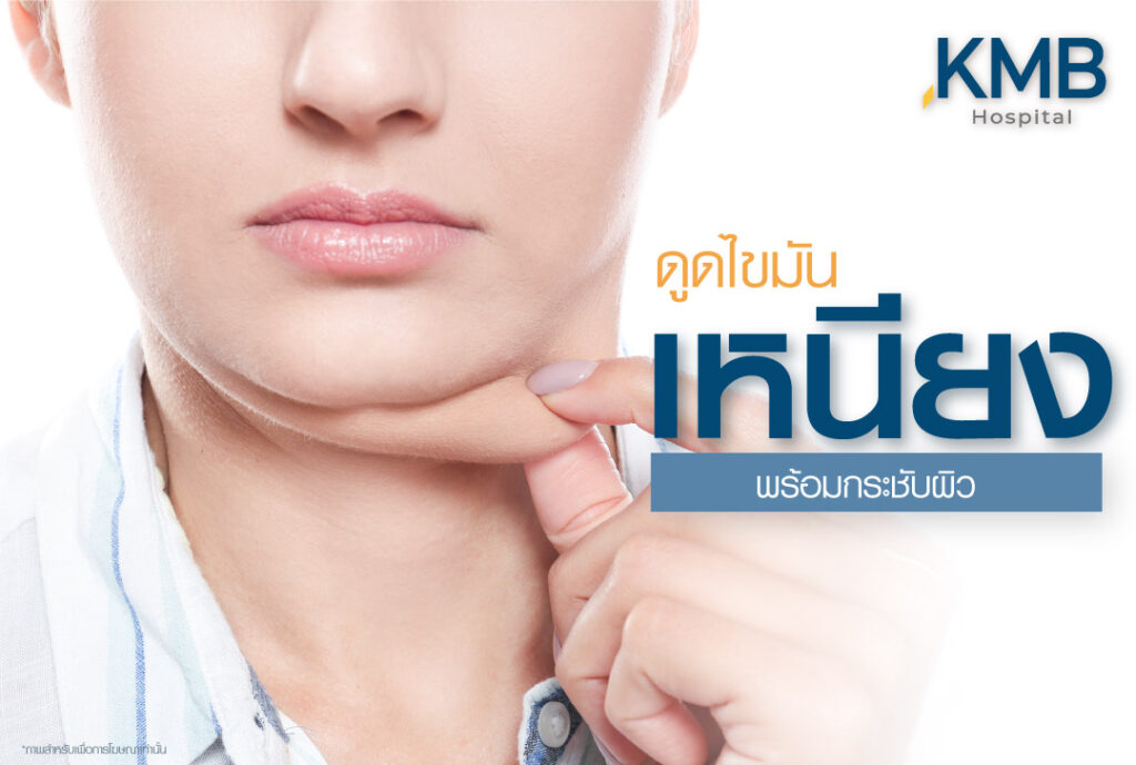 ดูดไขมัน เหนียง