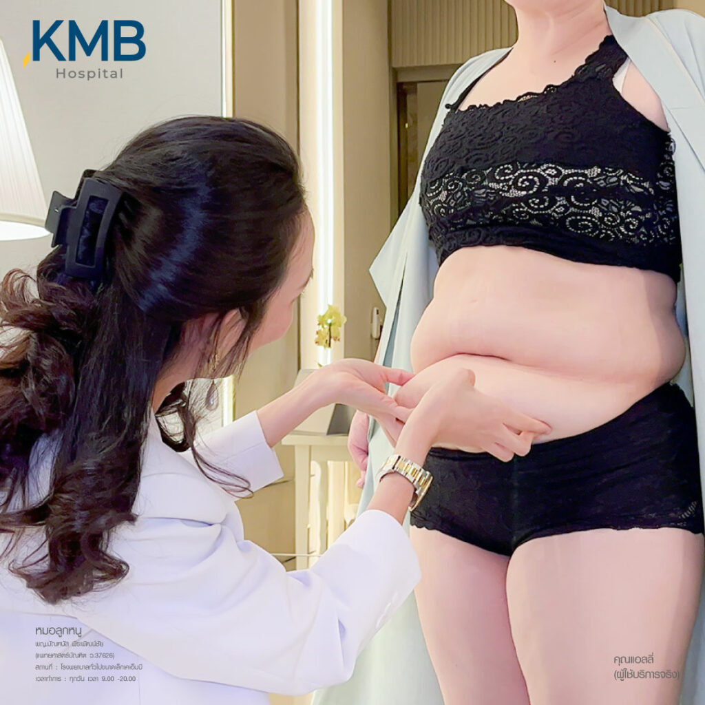 ดูดไขมัน-หมอลูกหนู