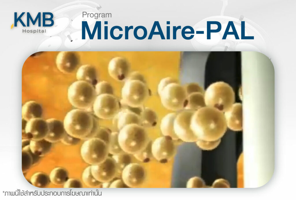 ดูดไขมัน-Microaire PAL