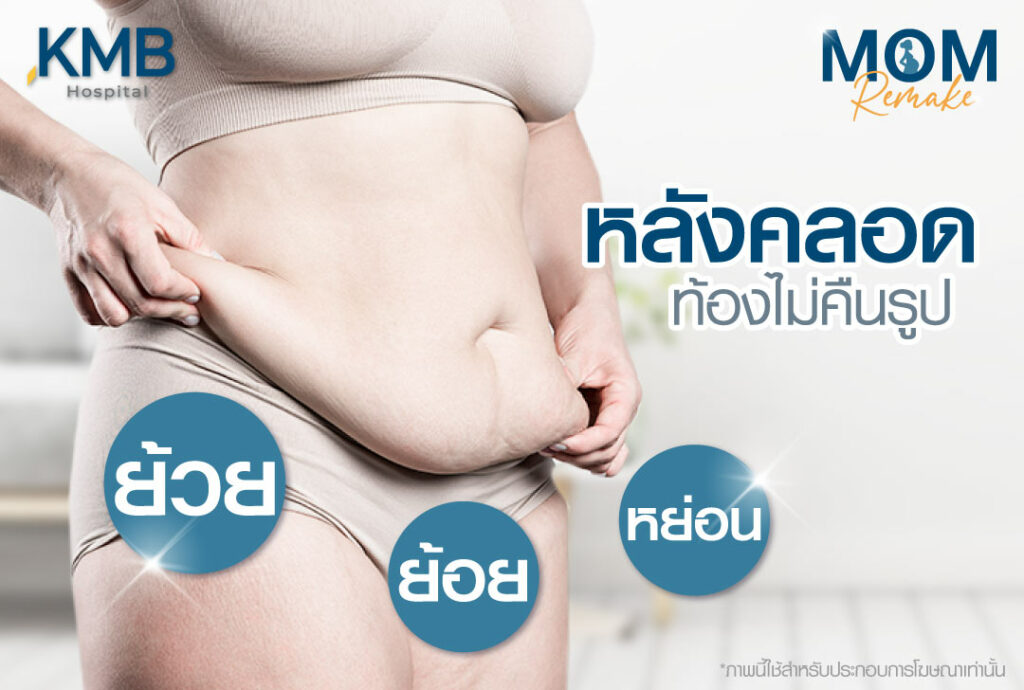 แม่หลังคลอด-หมอลูกหนู
