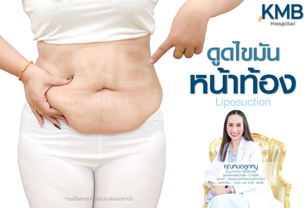 ดูดไขมันหน้าท้อง หมอลูกหนู 