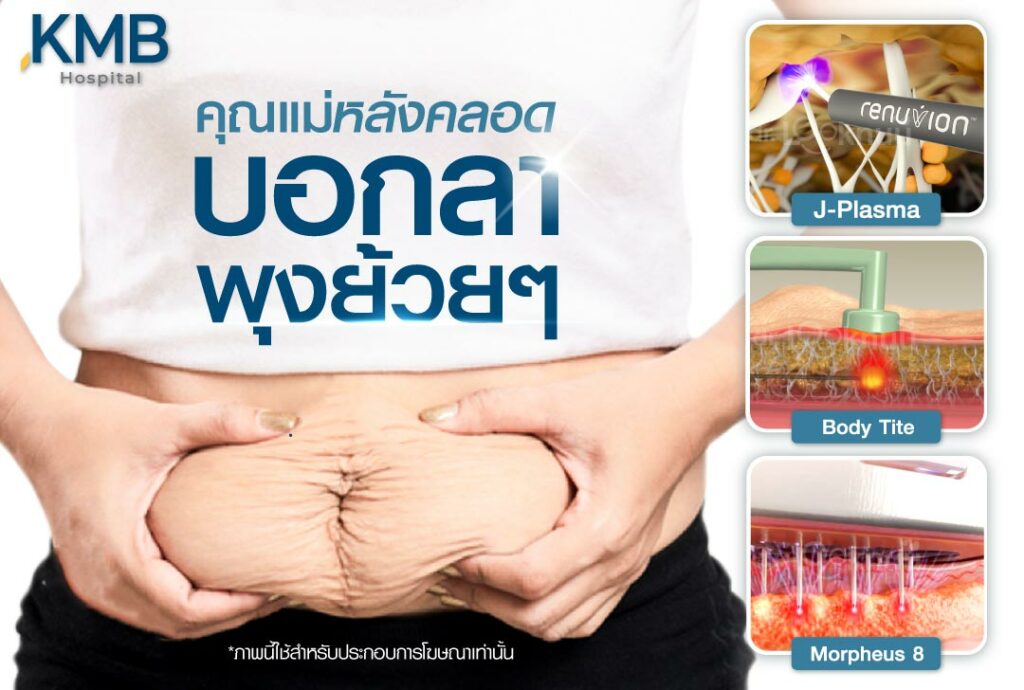 ดูดไขมันหน้าท้อง หมอลูกหนู