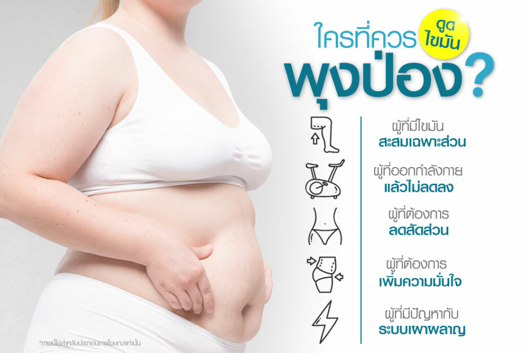 ดูดไขมันหน้าท้อง หมอลูกหนู