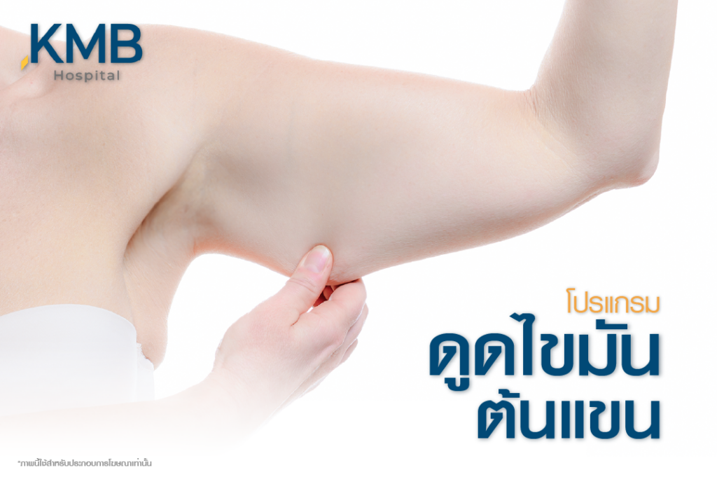 ดูดไขมันต้นแขน-หมอลูกหนู-KMB